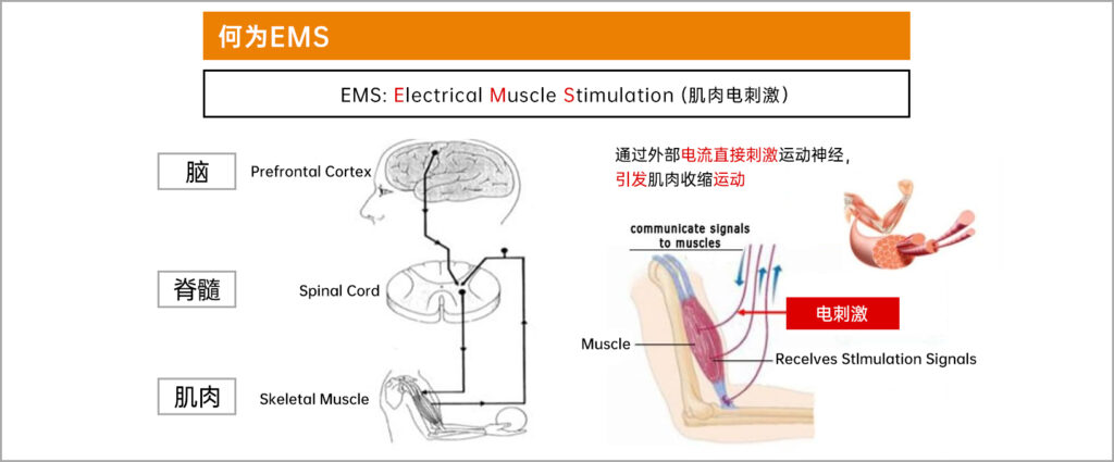 EMS肌肉电刺激在美容护理中的科学应用（images 1）